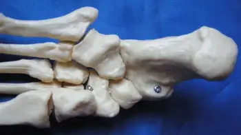 1:1 Natūralaus Dydžio Pėdos Sąnario Modelis Skeleto Modelis Žmogaus Pėdos Anatomijos Modelis Skeleto Modelių Žmogaus Mėginiai Medicinos Mokymo